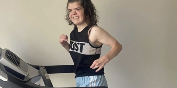 Carissa Resek, joven con síndrome de Apert