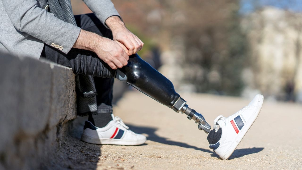Desarrollan una nueva prótesis biónica para mejorar la movilidad en personas con amputaciones por encima de la rodilla