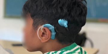 Roban el implante coclear a un niño en la Playa de La Antilla