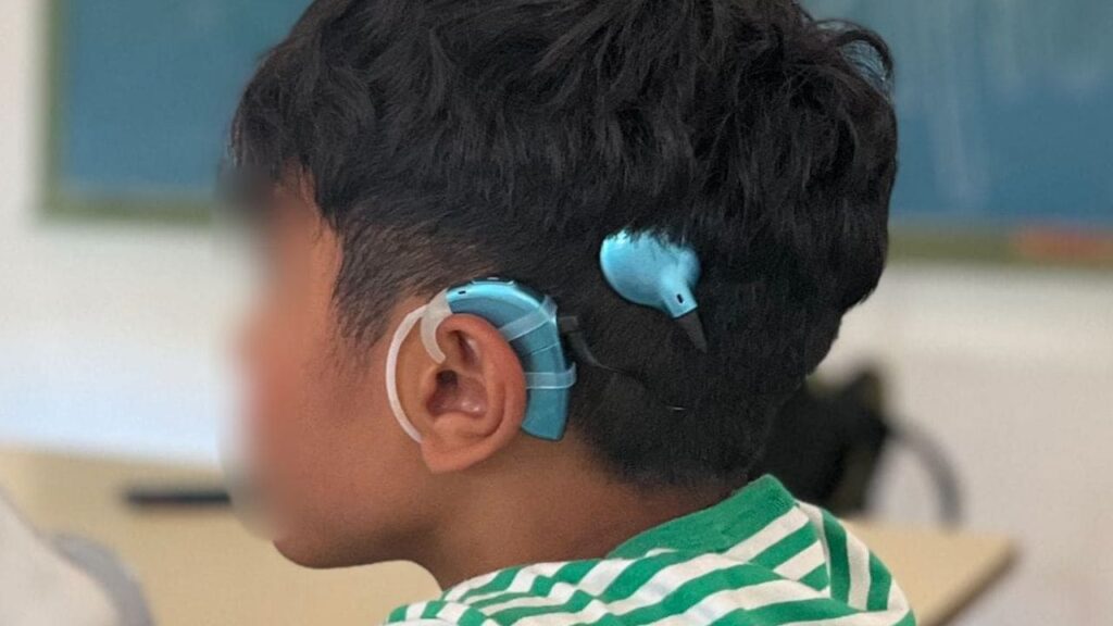 Roban el implante coclear a un niño en la Playa de La Antilla: «Sin él no puede oír»