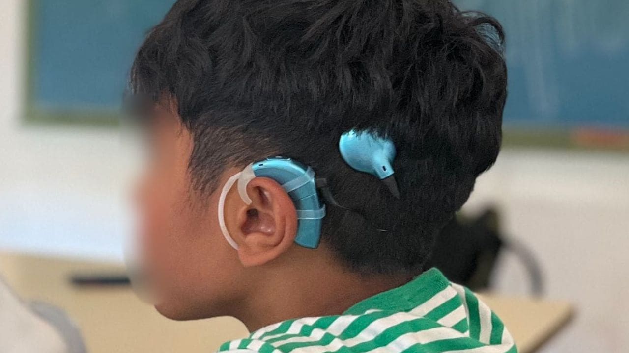 Roban el implante coclear a un niño en la Playa de La Antilla: «Sin él no puede oír»