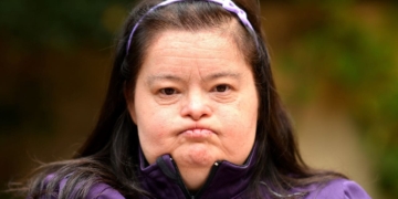 Envejecimiento saludable de las personas con síndrome de Down