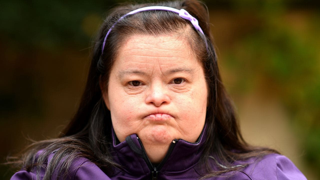 Envejecimiento saludable de las personas con síndrome de Down