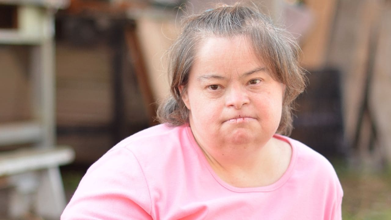 Alzheimer en personas con síndrome de Down mayores de 65 años