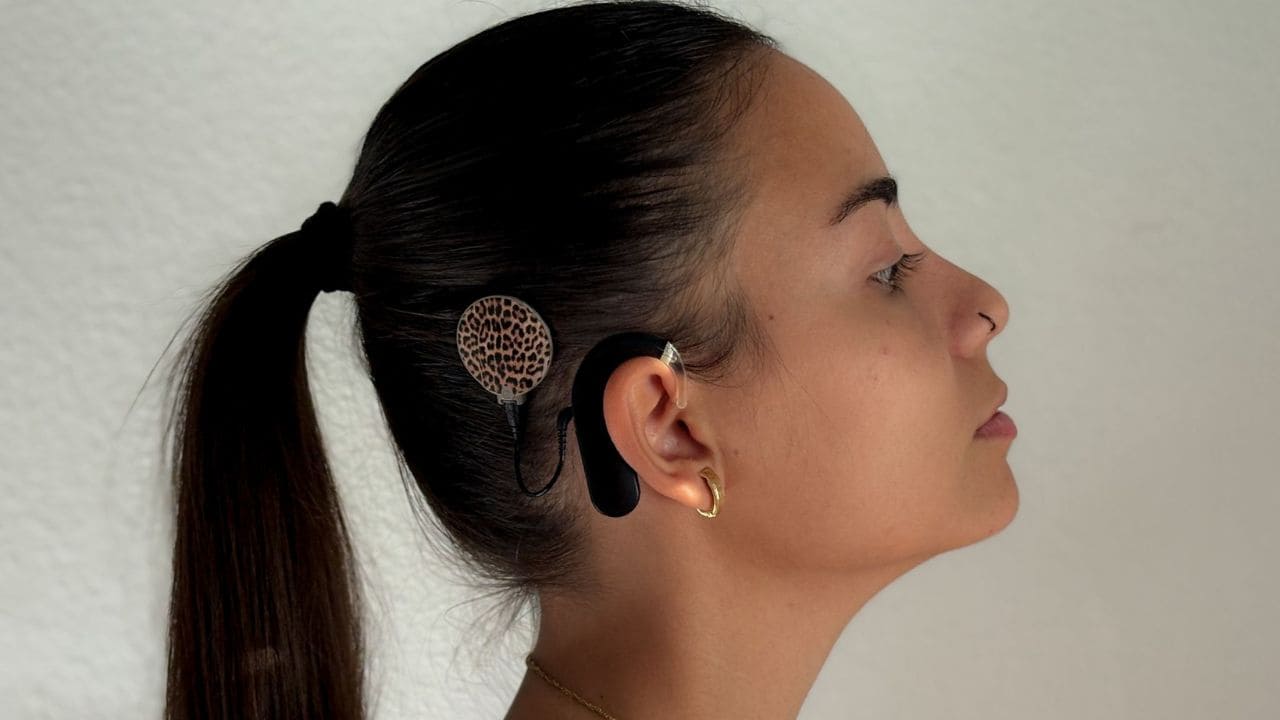 Estela Lorenzo, una enfermera en proceso con dos implantes cocleares / Imagen Estela Lorenzo para Tododisca