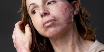 Isabel Irlandés, tres años de espera para valorar una discapacidad: "La administración también maltrata"