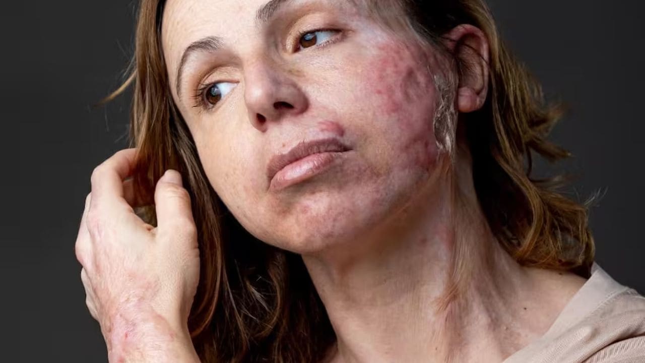 Isabel Irlandés, tres años de espera para valorar una discapacidad: "La administración también maltrata"