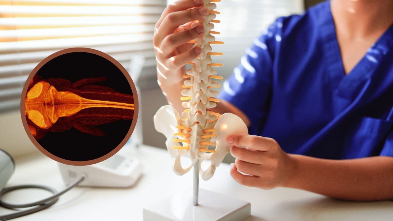 Descubren que el pez cebra es capaz de regenerar su médula espinal lesión medular