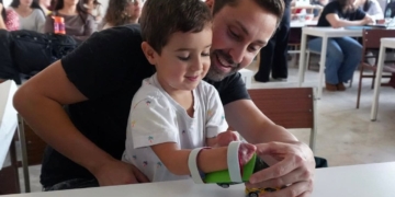 Mael, el pequeño que perdió manos y pies por una bacteria: "Cuánto más grande es la lucha, más grande es el triunfo"