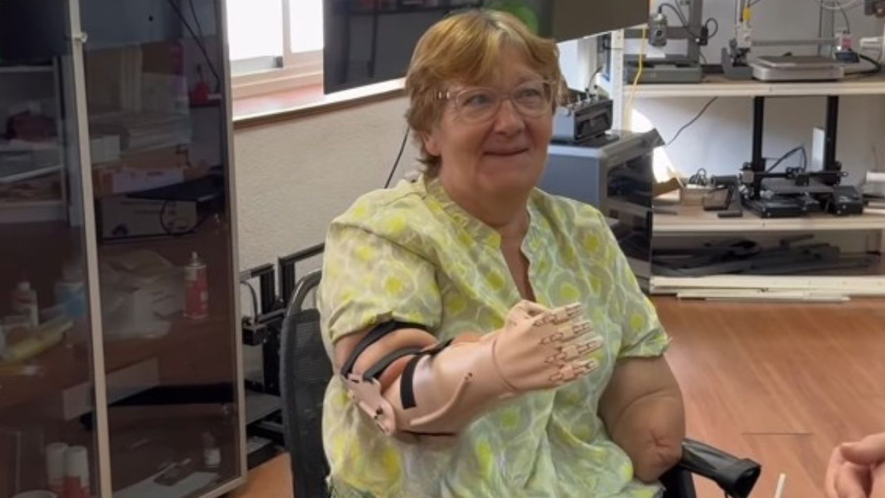 María Isabel vuelve a ‘tener’ brazos gracias a ‘Ayudame3d’: «Ayudar es demasiado fácil como para no hacerlo»