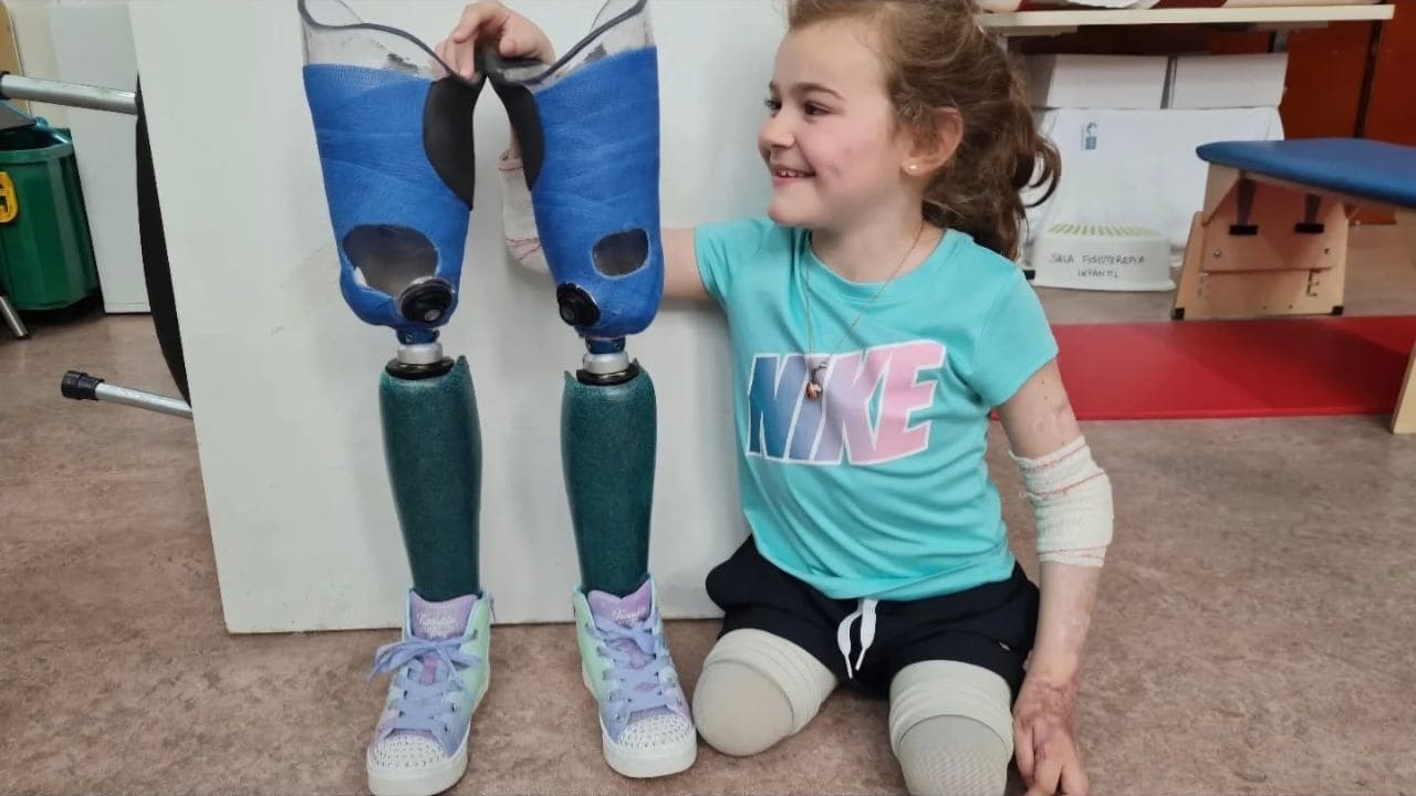 Ángela, marcada por una sepsis por meningococo desde los seis años: resiliencia, inclusión y amor propio