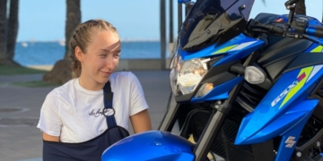 Aprender a vivir con una parálisis braquial: un recorrido por la vida de Ana Monedero