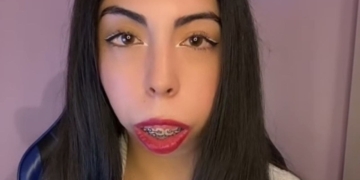 Claudia Yasmín y su batalla contra el síndrome Treacher Collins: "Mi salud está cada vez más comprometida"