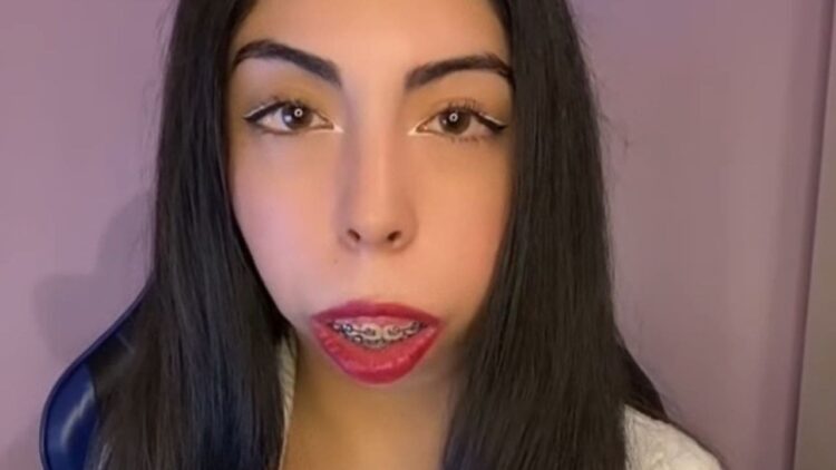 Claudia Yasmín y su batalla contra el síndrome Treacher Collins: "Mi salud está cada vez más comprometida"