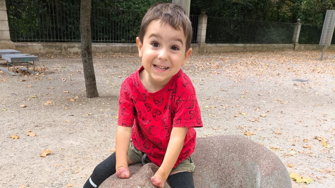 La batalla de Mael contra el 'dragón' del meningococo: perdió manos y pies, pero ganó la vida