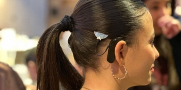 La denuncia de Estela Lorenzo, joven con discapacidad auditiva: "El implante coclear no es un juguete; es la vida de quien lo lleva"