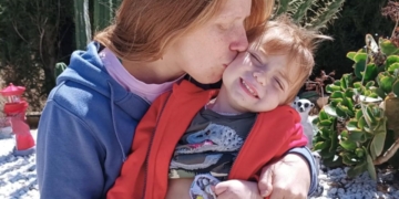 La lucha del pequeño Marcos contra la displasia epitelial intestinal: 365 días conectado a nutrición parenteral