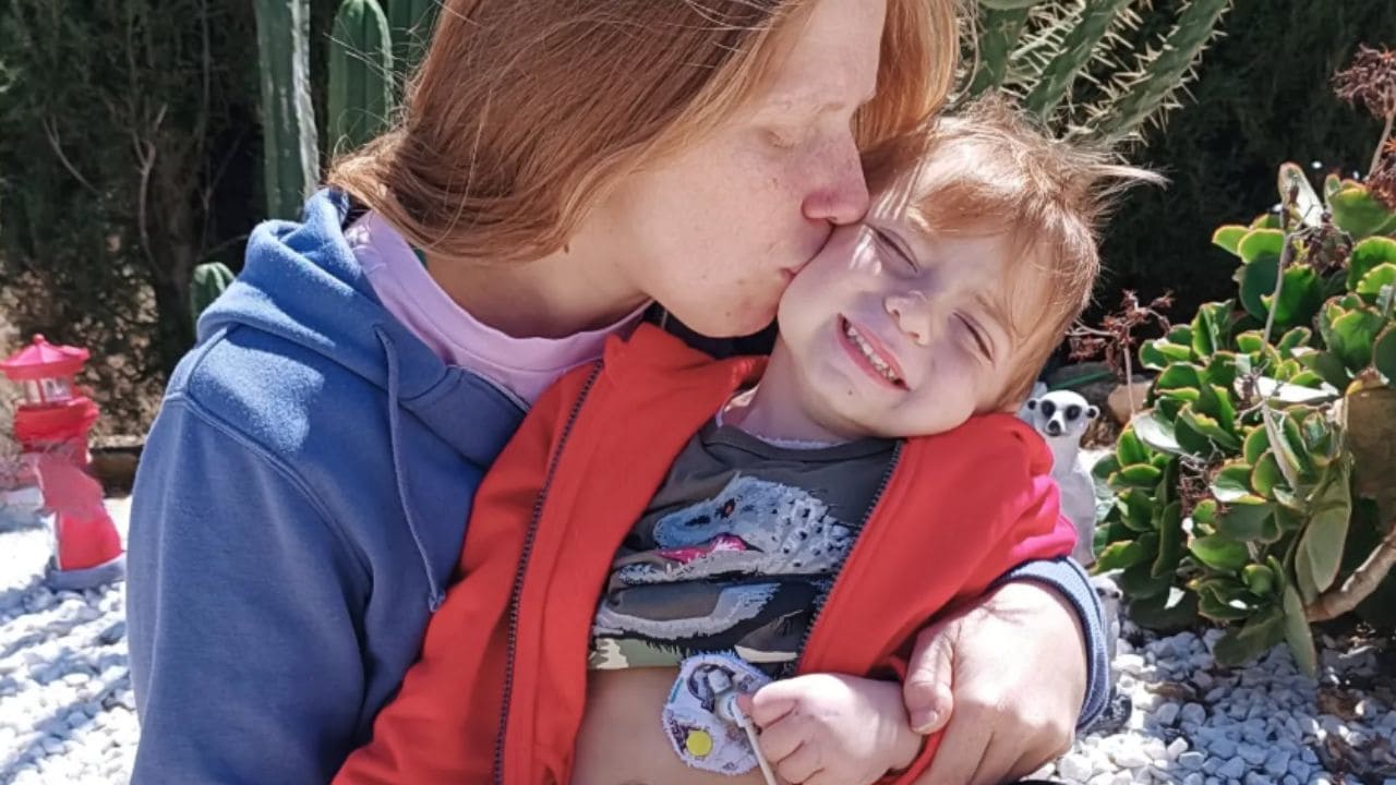 La lucha del pequeño Marcos contra la displasia epitelial intestinal: 365 días conectado a nutrición parenteral