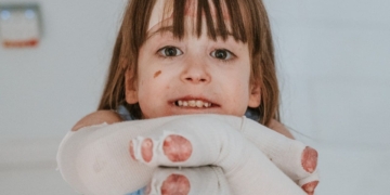 Vyjuvek, un medicamento contra la Piel de Mariposa que reclaman en España: "Esperar no es una opción"