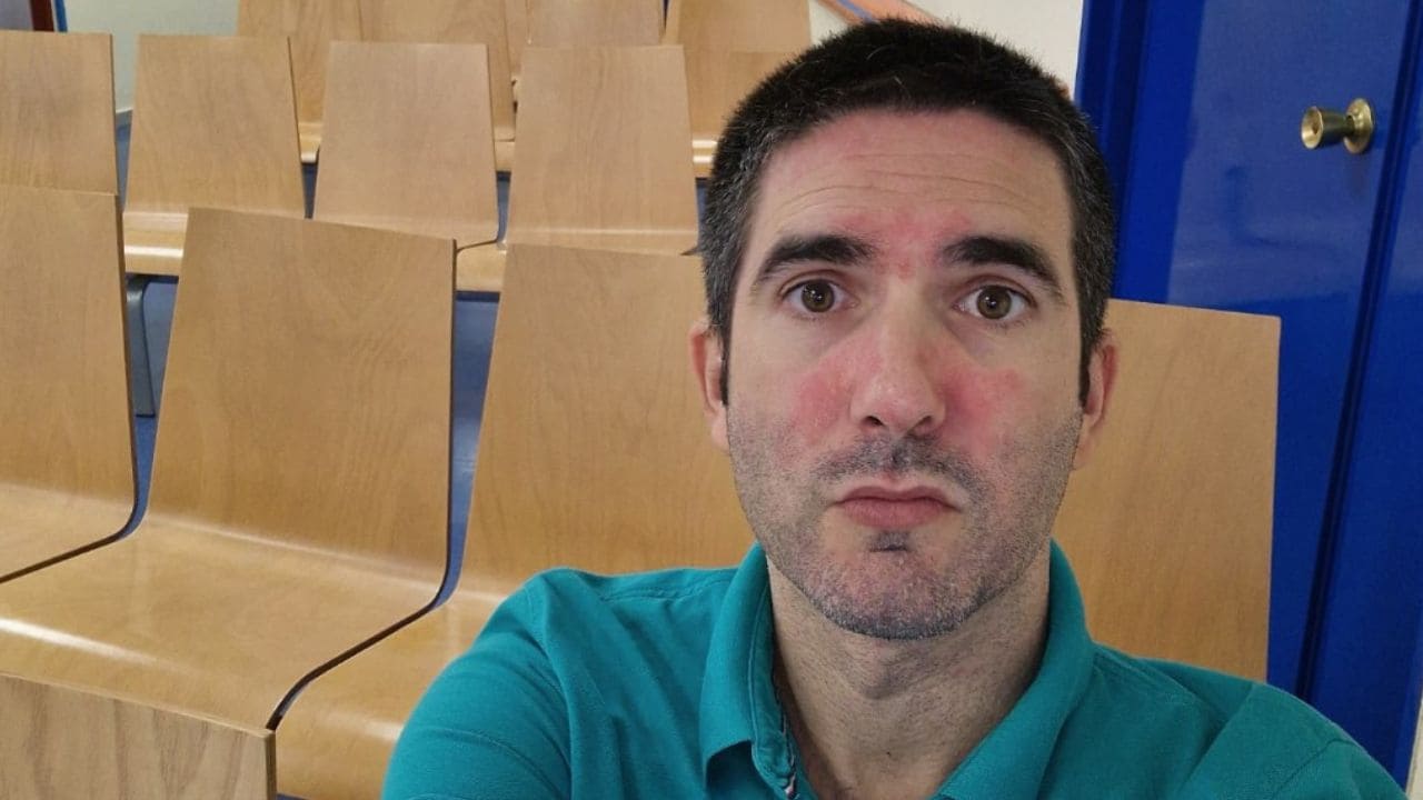 Carlos Solas, divulgador de la ‘discapacidad invisible’: «Necesito comprensión, no juicio»