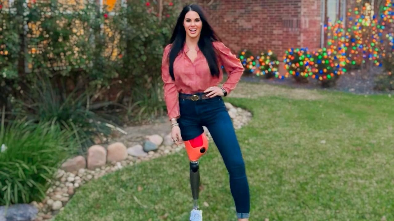 Jamie Blanek, la "mujer maravilla de una pierna": atleta y oradora motivacional tras un accidente que le cambió la vida