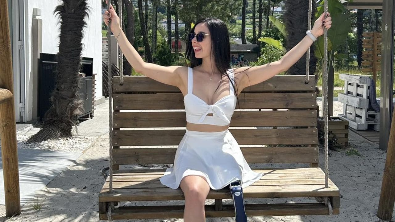 La prótesis de pierna, una «aliada» para Daniela Grisales: influencer que transforma cada paso en «libertad y poder»