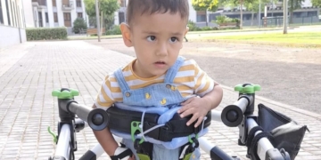 Las secuelas de 'Pablito', un "auténtico guerrero" contra la meningitis: parálisis cerebral baja visión y epilepsia