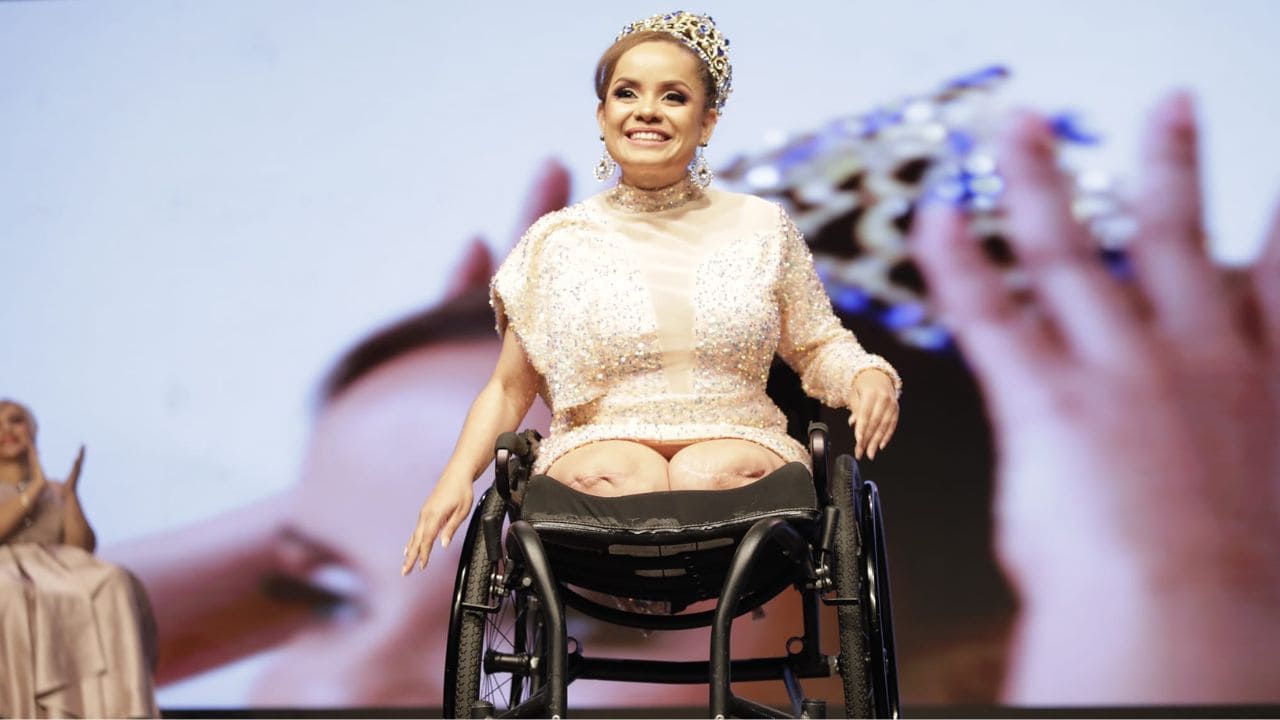 María de León, modelo amputada de piernas: "Necesitamos la diversidad en el mundo para enfrentar desafíos"