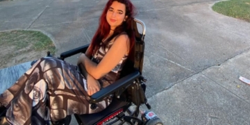 Marlys Ruiz, modelo con discapacidad en Cuba