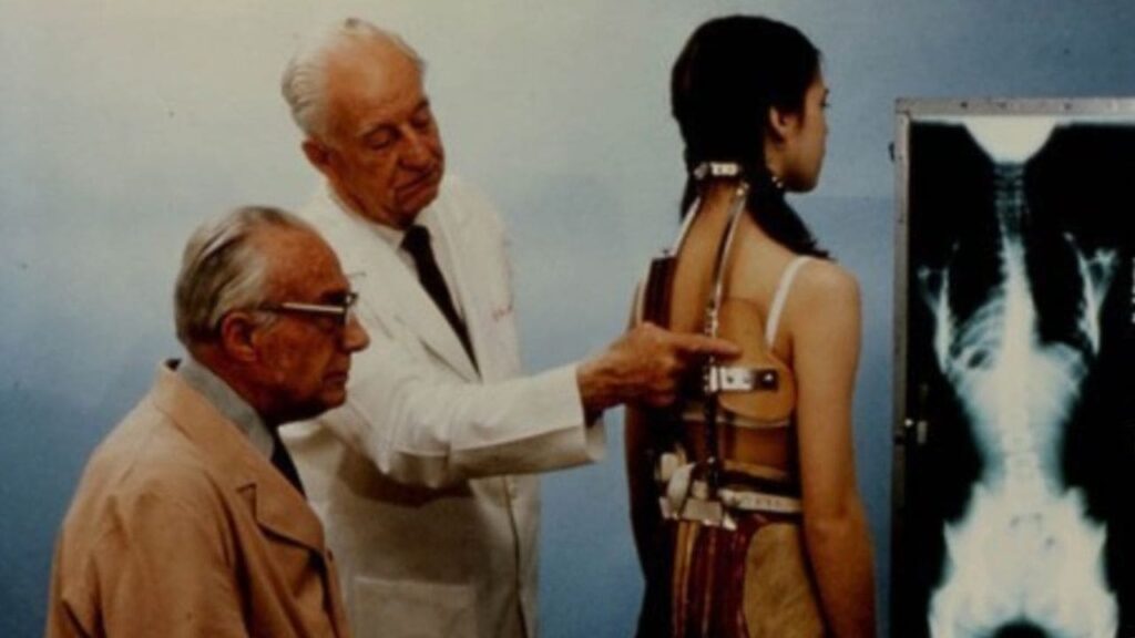 El corsé ‘Milwaukee’, uno de los avances más importantes en la historia de la ortopedia, cumple 80 años