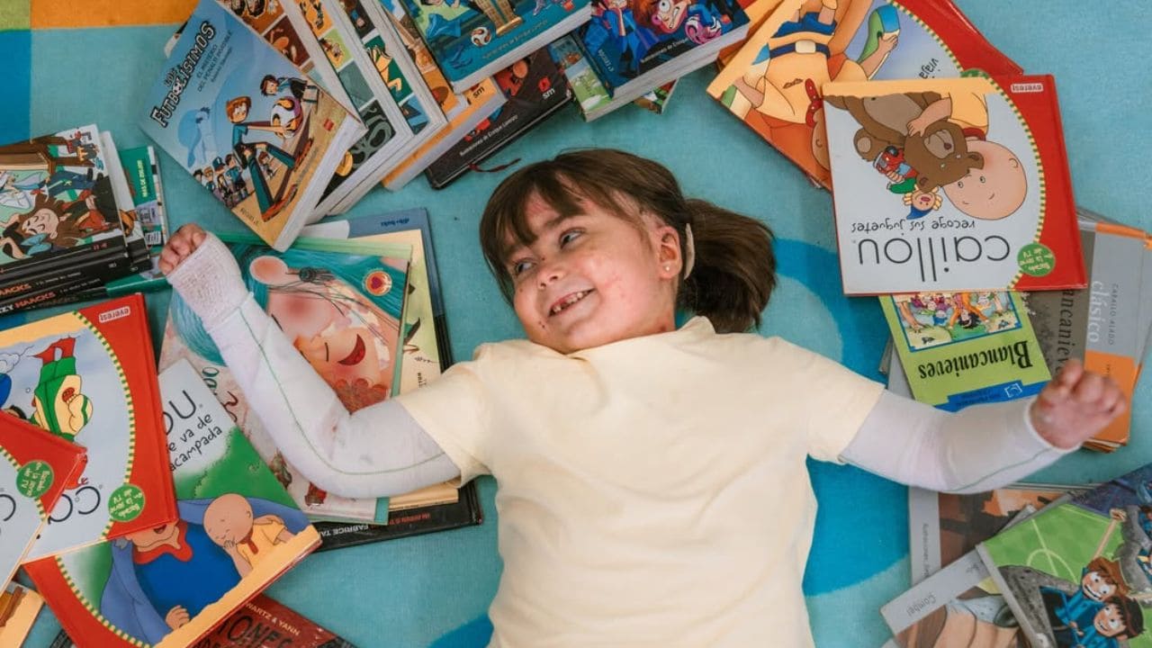 Famosos y artistas se unen para pedir la llegada a España del tratamiento para la Piel de Mariposa