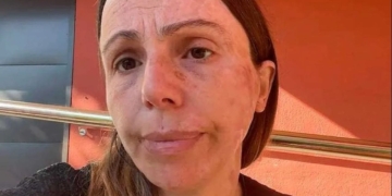 Isabel Irlandés, superviviente de un accidente ferroviario: "Somos personas, familias rotas, niños marcados de por vida"