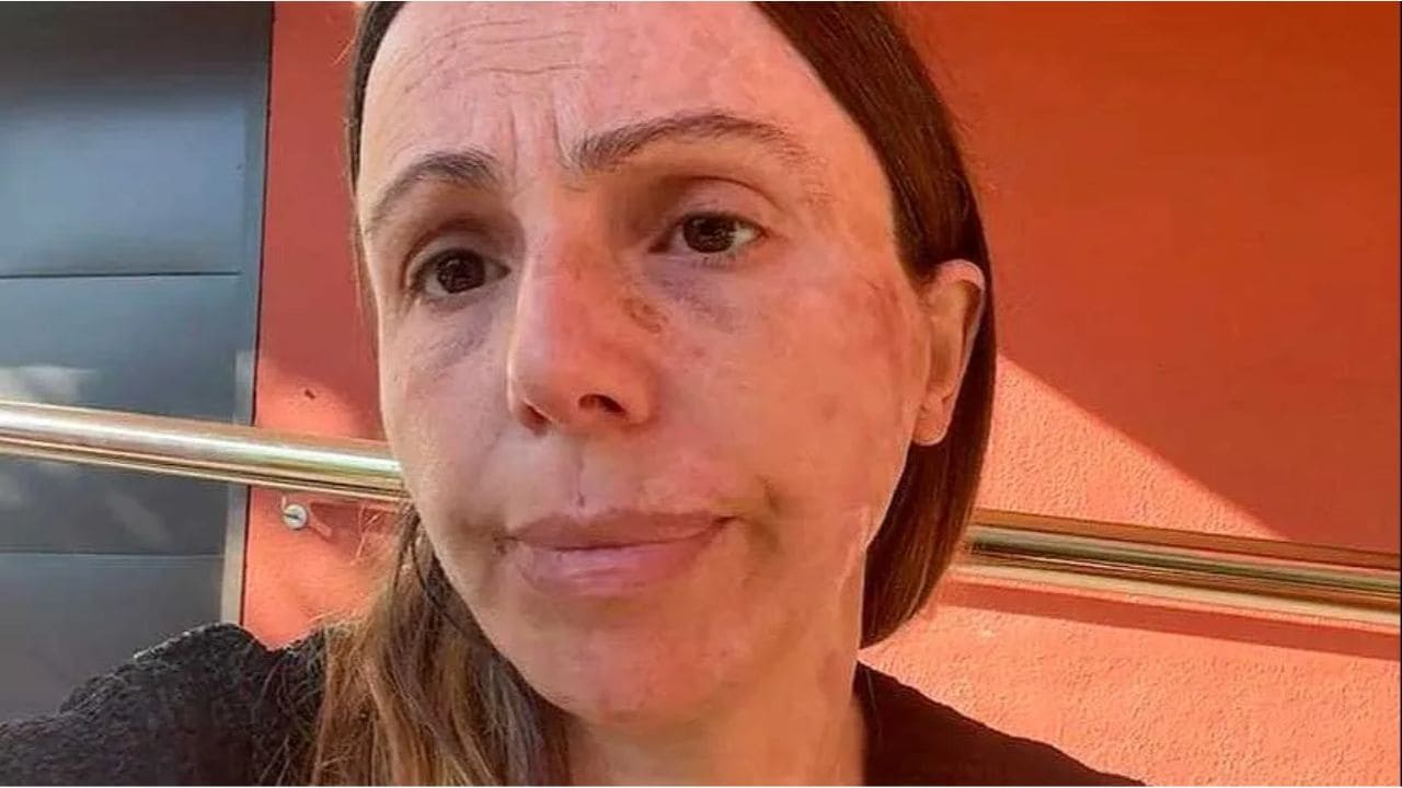 Isabel Irlandés, superviviente de un accidente ferroviario: "Somos personas, familias rotas, niños marcados de por vida"