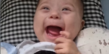 La sonrisa de Balta, un bebé con síndrome de Down, al recibir el alta del hospital
