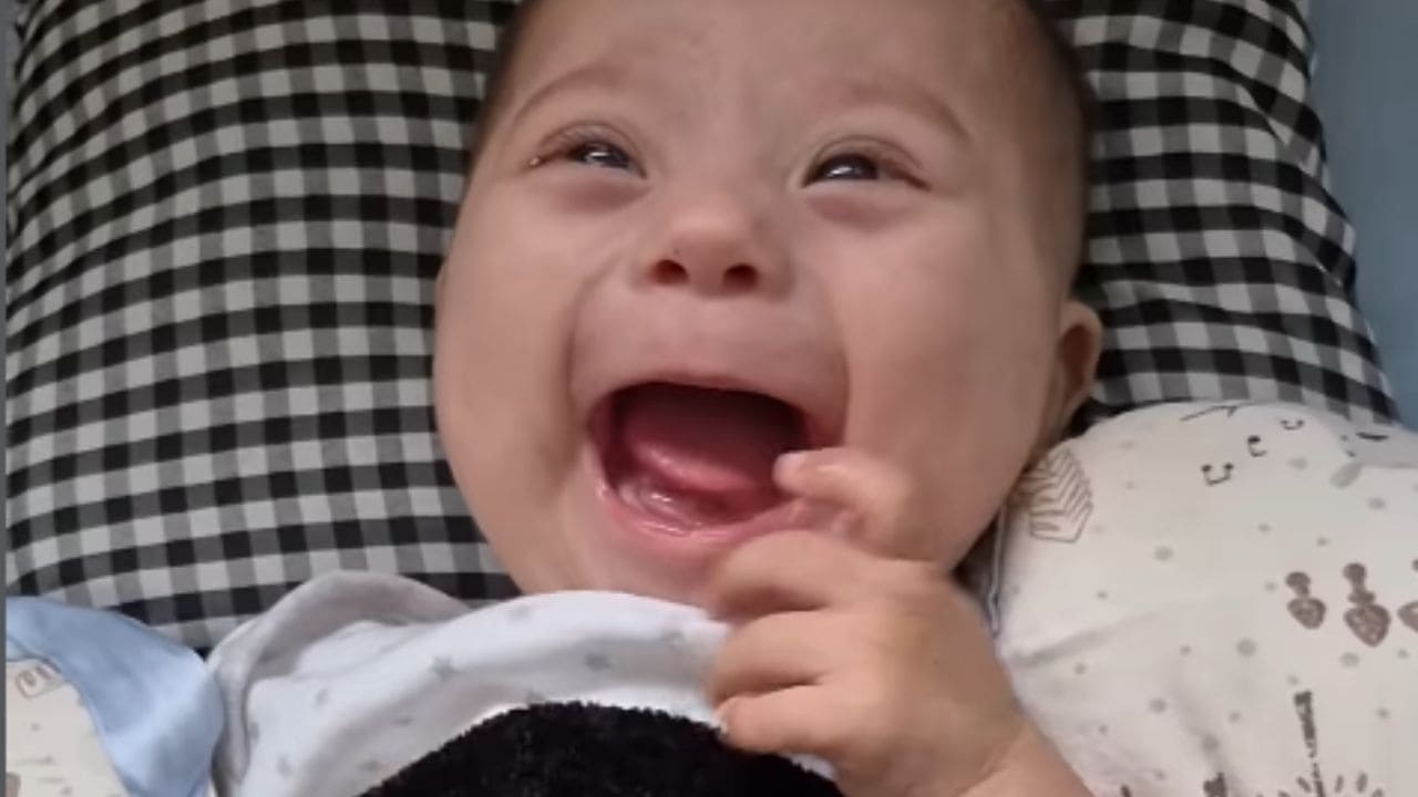 La sonrisa de Balta, un bebé con síndrome de Down, al recibir el alta del hospital