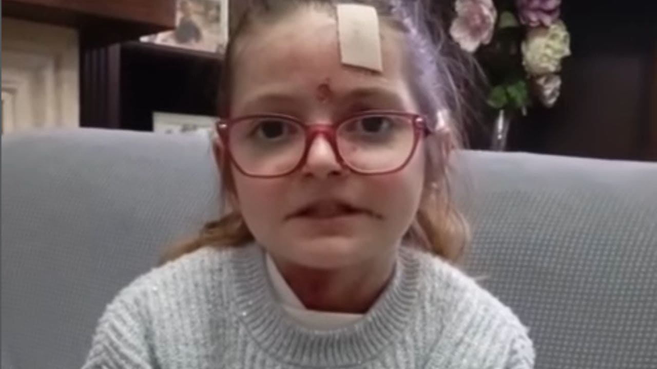 Laura, una niña de 10 años con Piel de Mariposa, ruega la llegada a España del tratamiento que "cure nuestras heridas"