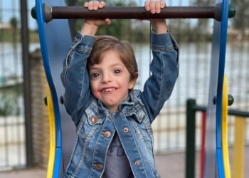 Manuel, el niño que sueña con ser músico mientras batalla con el síndrome de Dandy Walker