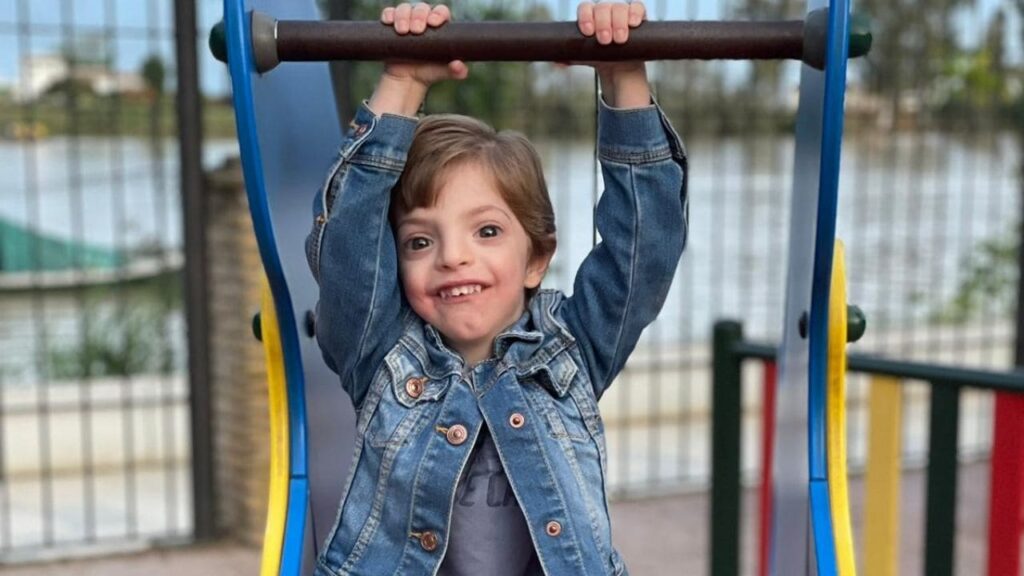 Manuel, el niño que sueña con ser músico mientras batalla con el síndrome de Dandy Walker