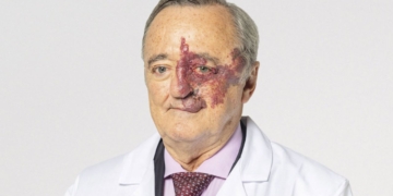 Científicos españoles logran eliminar por primera vez tumores de páncreas de manera completa