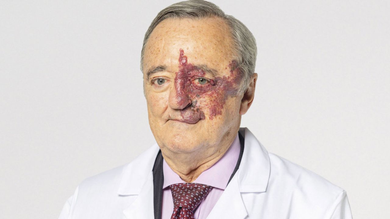 Científicos españoles logran eliminar por primera vez tumores de páncreas de manera completa