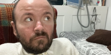 Álvaro González, joven con discapacidad pension