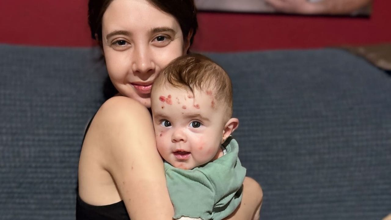 Ana Domenech, madre de una niña con Piel de Mariposa: "Ninguna de sus heridas le quita las ganas de vivir"