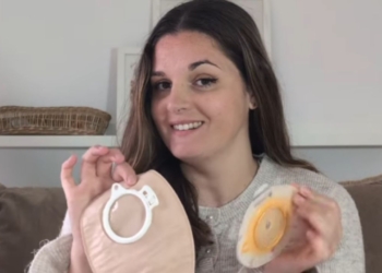 Anna Bellart y su importante misión de dar visibilidad a las personas ostomizadas