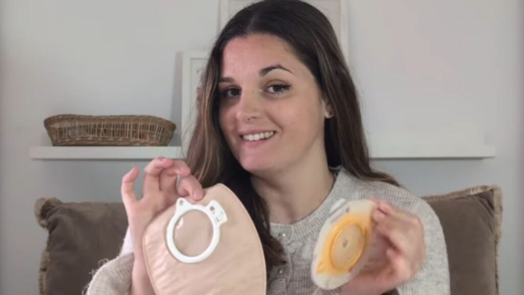 Anna Bellart y su importante misión de dar visibilidad a las personas ostomizadas