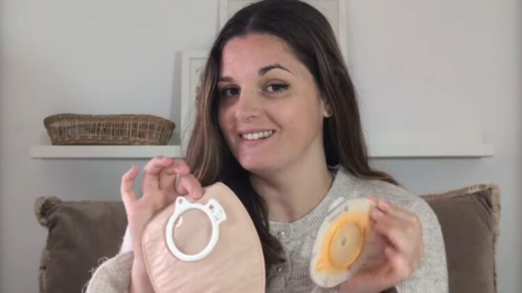 Anna Bellart y su importante misión de dar visibilidad a las personas ostomizadas