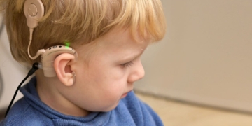 Día Internacional del Implante Coclear: Una "puerta abierta" a la comunicación, participación y aprendizaje