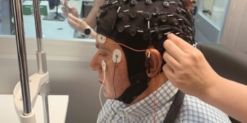 Un hombre ciego recupere la visión natural con un implante cerebral
