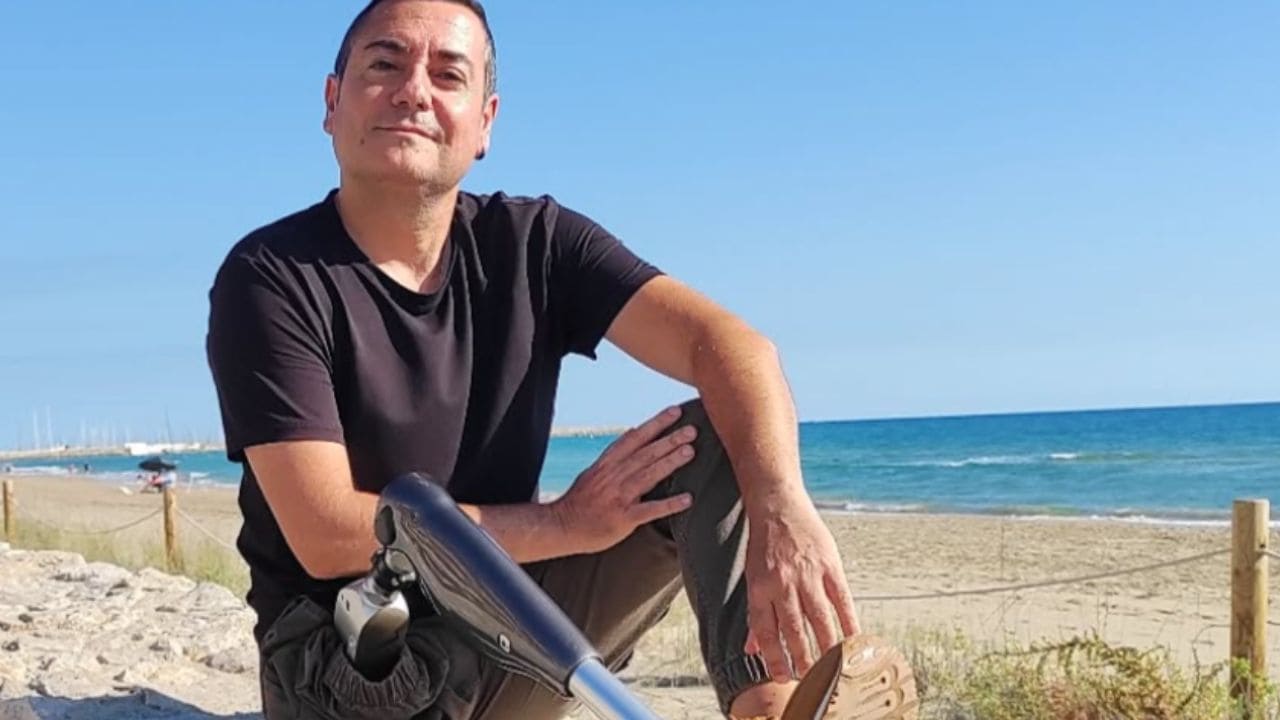 Jorge Delgado vence al cáncer por segunda vez, aunque perdió la pierna para salvar su vida