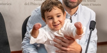 La lección sobre inclusión de Mael, un niño sin piernas ni brazos: “Mirar de igual a igual”