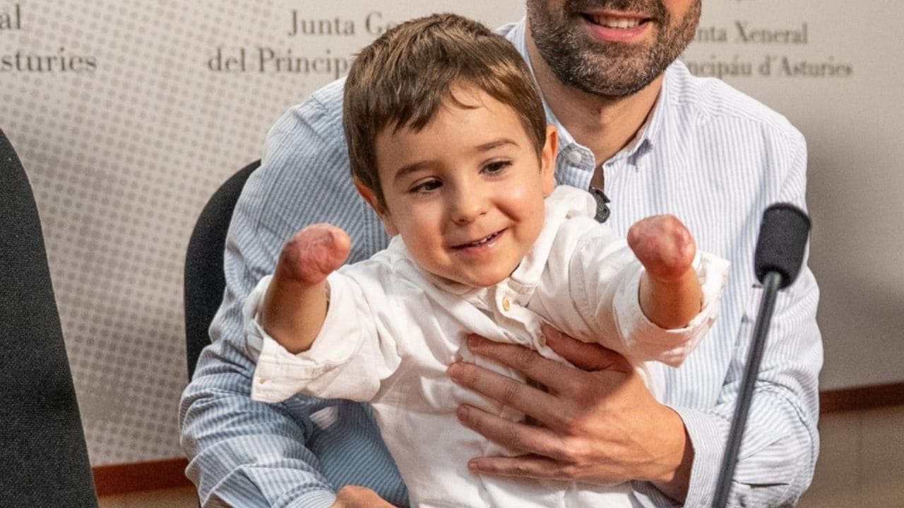 La lección sobre inclusión de Mael, un niño sin piernas ni brazos: “Mirar de igual a igual”